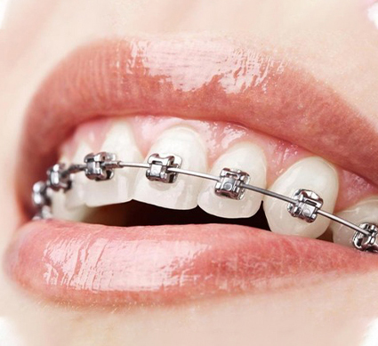 Orthodontics